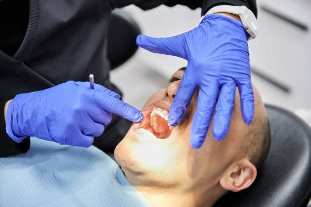 Best Knocked-Out Tooth (Avulsed Tooth) Treatment in Plum Grove, TX
