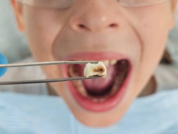 Best Emergency Denture Repair in Plum Grove, TX
